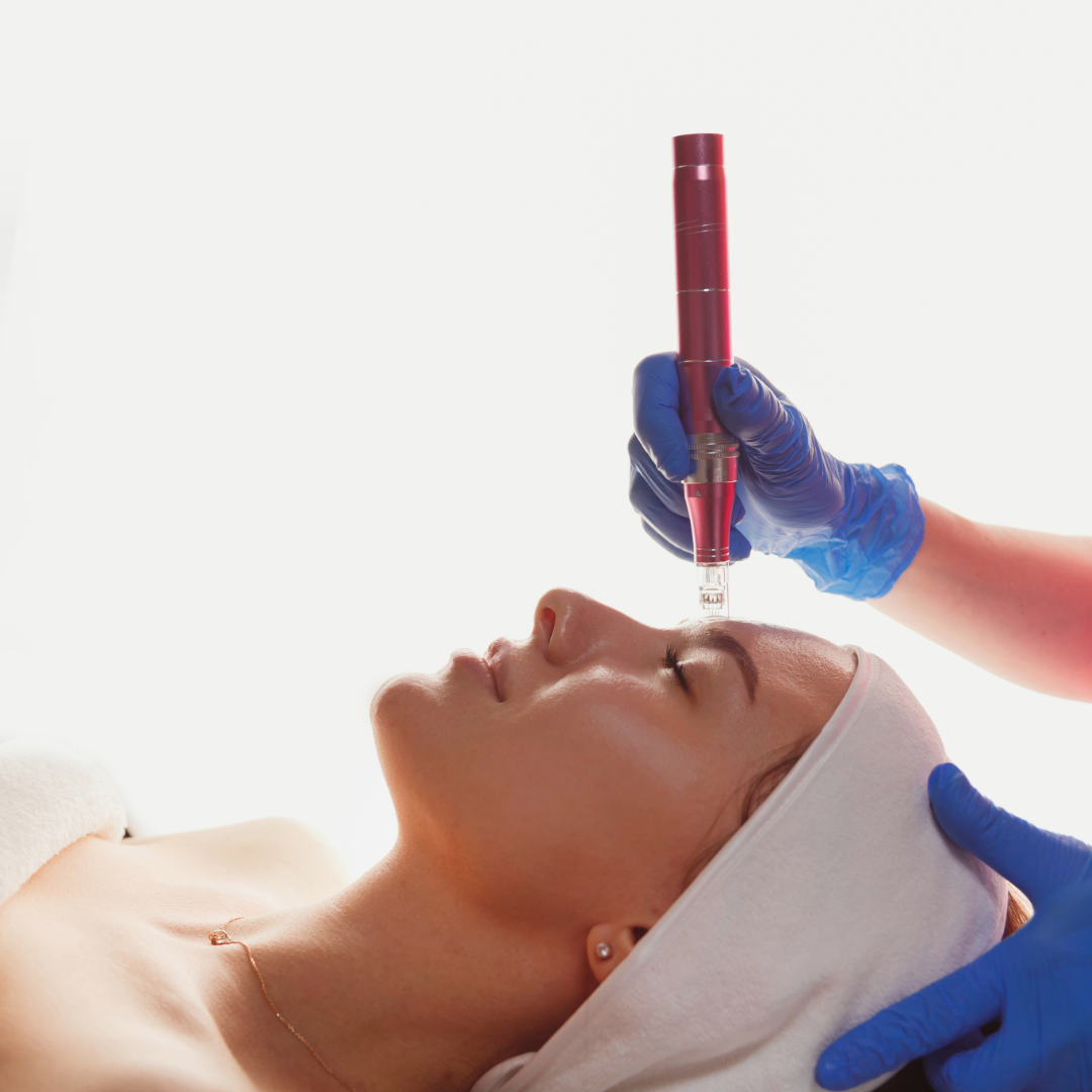 Microneedling (Ansikte + Hals) - 1 Behandling